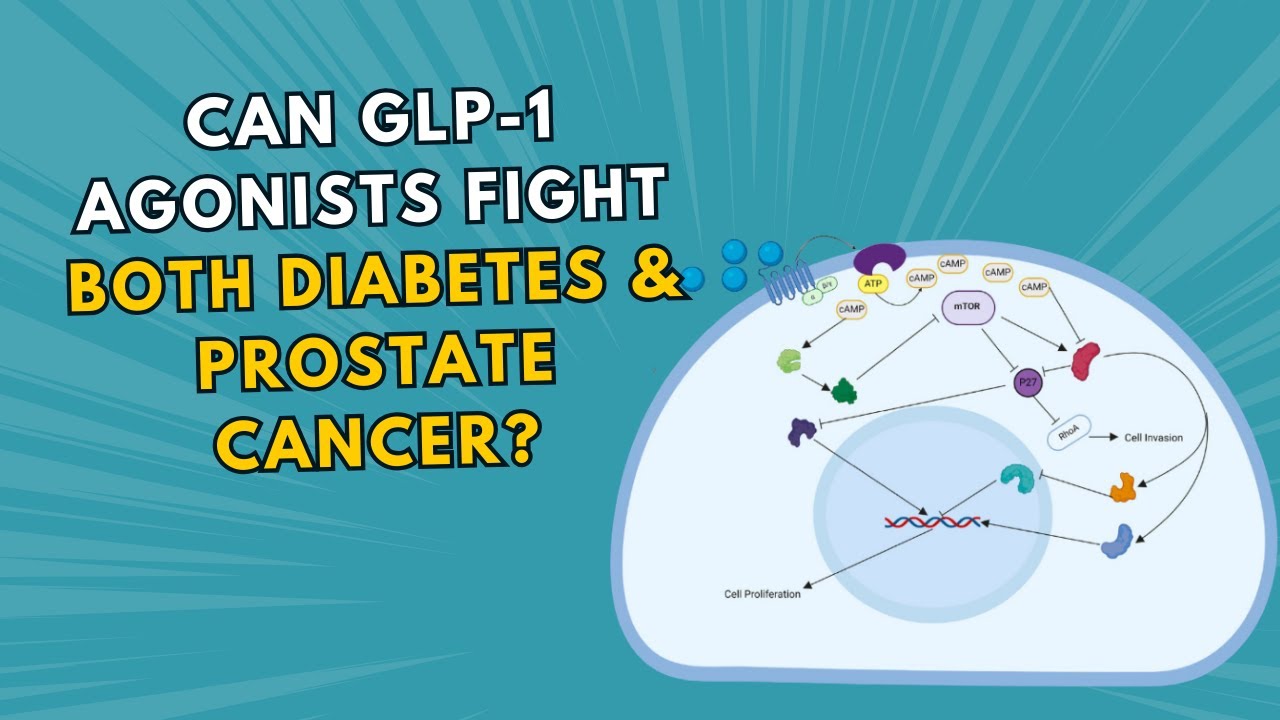 glp 1 and prostate cancer GLP-1 Agonists: Dual Benefits for Diabetes and Cancer