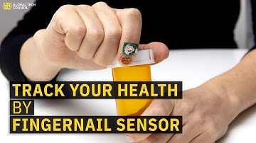 AI-based Fingernail sensor developed by IBM keeps track of Patients Health | Global Tech Council