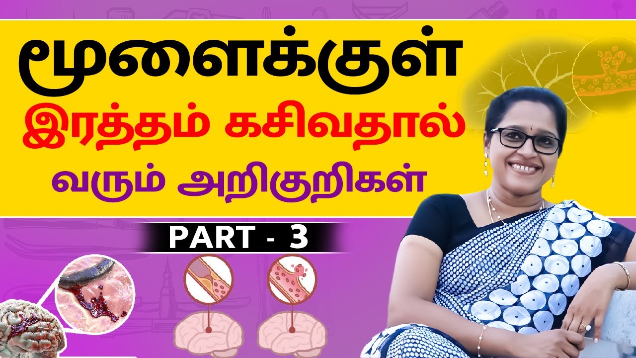மூளைக்குள் இரத்தம் கசிவதால் வரும் அறிகுறிகள் | Dr. A.Veni - Rockfort Neuro Centre | Part 3 | Trichy