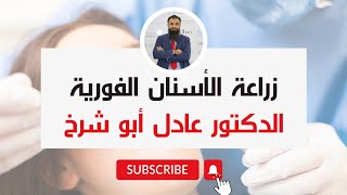 زراعة الأسنان الفورية بدون الحاجة الى جراحة | الدكتور عادل أبو شرخ |