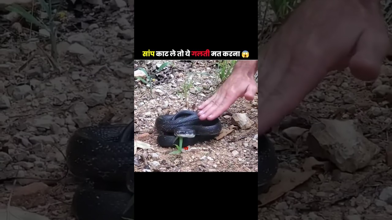 How To Survive A Snake Bite 😱/ 