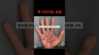 갑자기 사고나는 손금