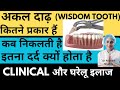 अकल दाढ़ क्या है (Wisdom Tooth) |अकल दाढ़ निकलते वक़्त दर्द क्यों होता है | इस के प्रकार और घरेलु उपचार