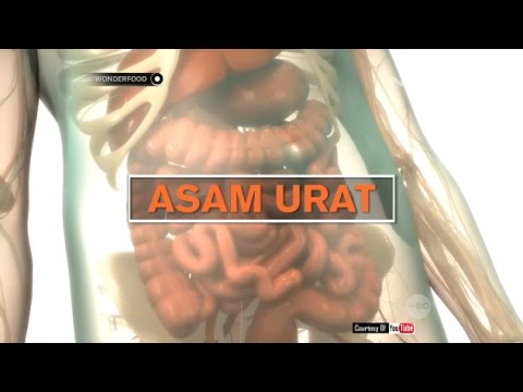 Ini Dia Gejala Penyakit Asam Urat