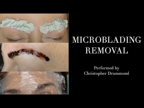 Fixing Botched Microblading: How I Correct Bad Eyebrow Tattoos by celebrity cosmetic tattoo artist