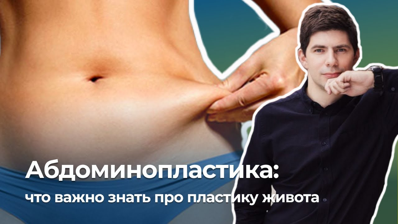 Абдоминопластика - пластика живота. Важные моменты при абдоминопластики. Диастаз.