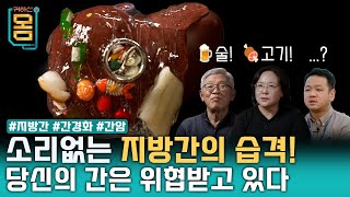 [Full] 귀하신 몸 - 30화 좋은 간, 나쁜 간, 이상한 지방간