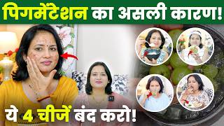 झाइयां दूर करने का सबसे आसान और सुरक्षित 4-Step तरीका | 21 Days Challenge | 100% Effective Remedy