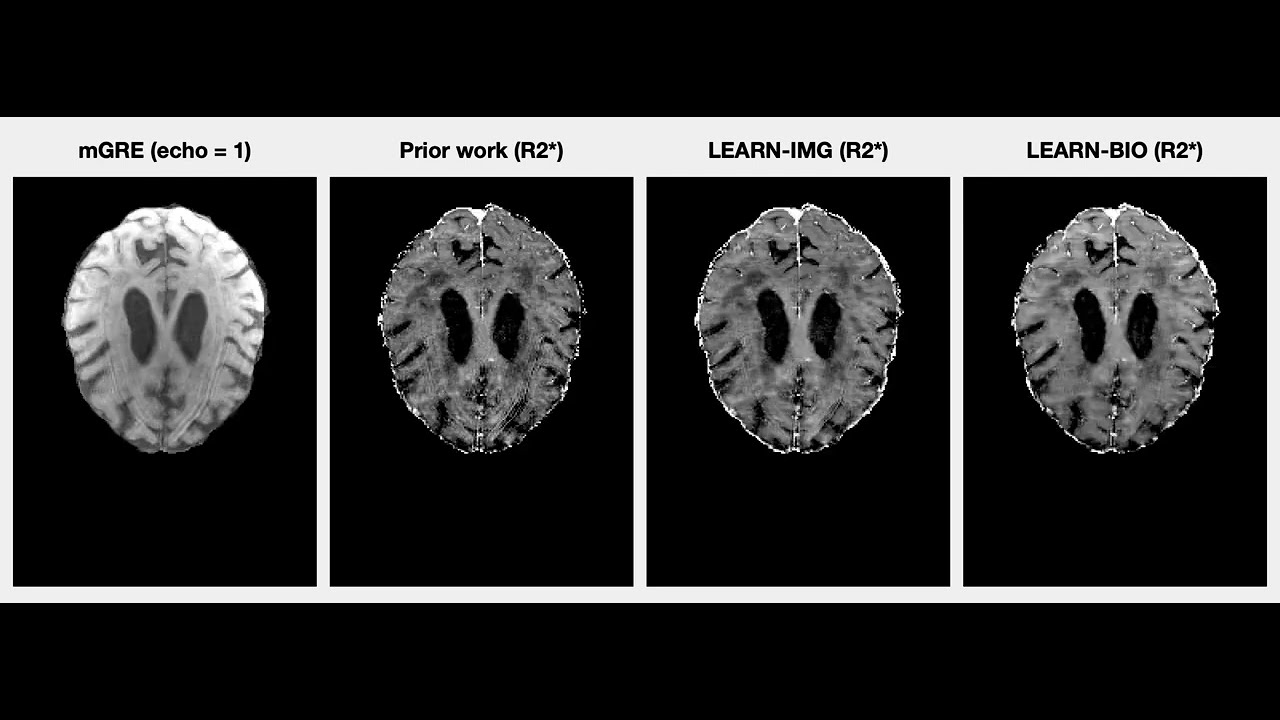 Learningbased Motion Artifact Removal Networks (LEARN) for