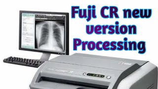 Fuji CR System new version