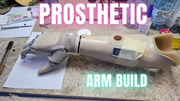 Prosthetic arm build, including a Taska hand!