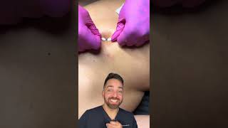 Derm Reacts to Skin Extraction | Doctorly #shorts