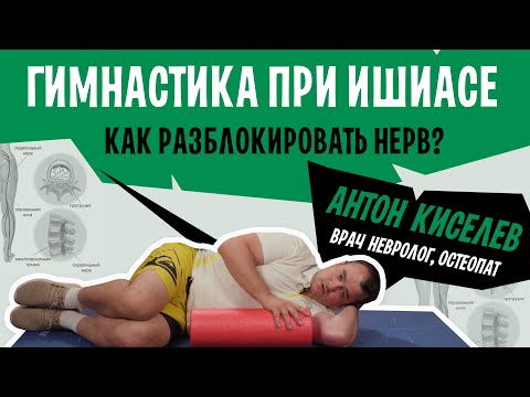 Ишиас, упражнения для лечения. Гимнастика и ЛФК от защемления седалищного нерва | Антон Киселев