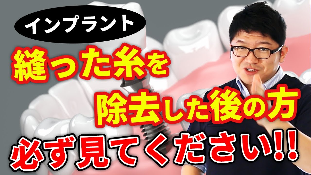 【インプラント】縫った糸を除去した後の方、必ず見てください！！【吉岡歯科医院】