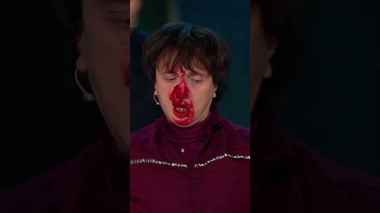 Шоу "Звёзды" Дорох разбил нос, шок!  