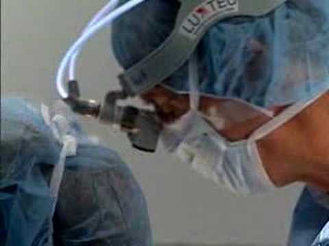 Hepatectomy w/ Radiofrequency Resection