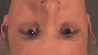 Видео Бинокулярная непрямая офтальмоскопия (автор: МЕДТЕХНИКА СТОЛИЦА)