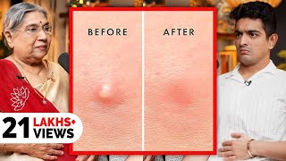 Fastest Pimple Healing Exercise & Hacks Explained - Yoga For Clear Skin