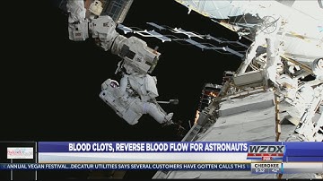 Blood clots, reverse blood flow found in astronauts