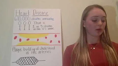 Amanda Glasgow - Heart Disease