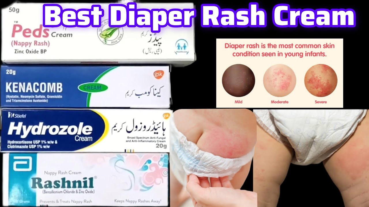 Pakistan Rash 62 Nappy Rash Cream for Baby | Best Rash Cream For Babies in Pakistan, # ...