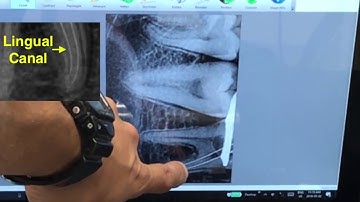 Part 3 - Shift Shot with Dex - This One File May Make All The Difference During WL!