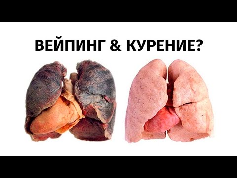 Видео: Синус-флеш: как сделать это безопасно