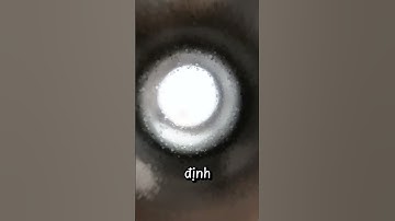 🔥Ống nhòm cửa hay mắt thần cửa giúp bảo vệ tính riêng tư và an toàn cho bạn