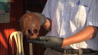 Unwrapping A 2000 Year Old Red Haired Elongated Headed Mummy In Peru