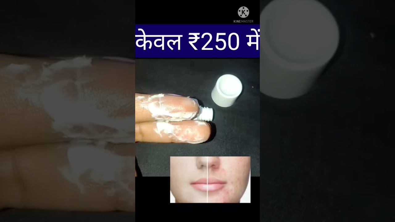 no scar cream for remove dark spot for face watching full video 