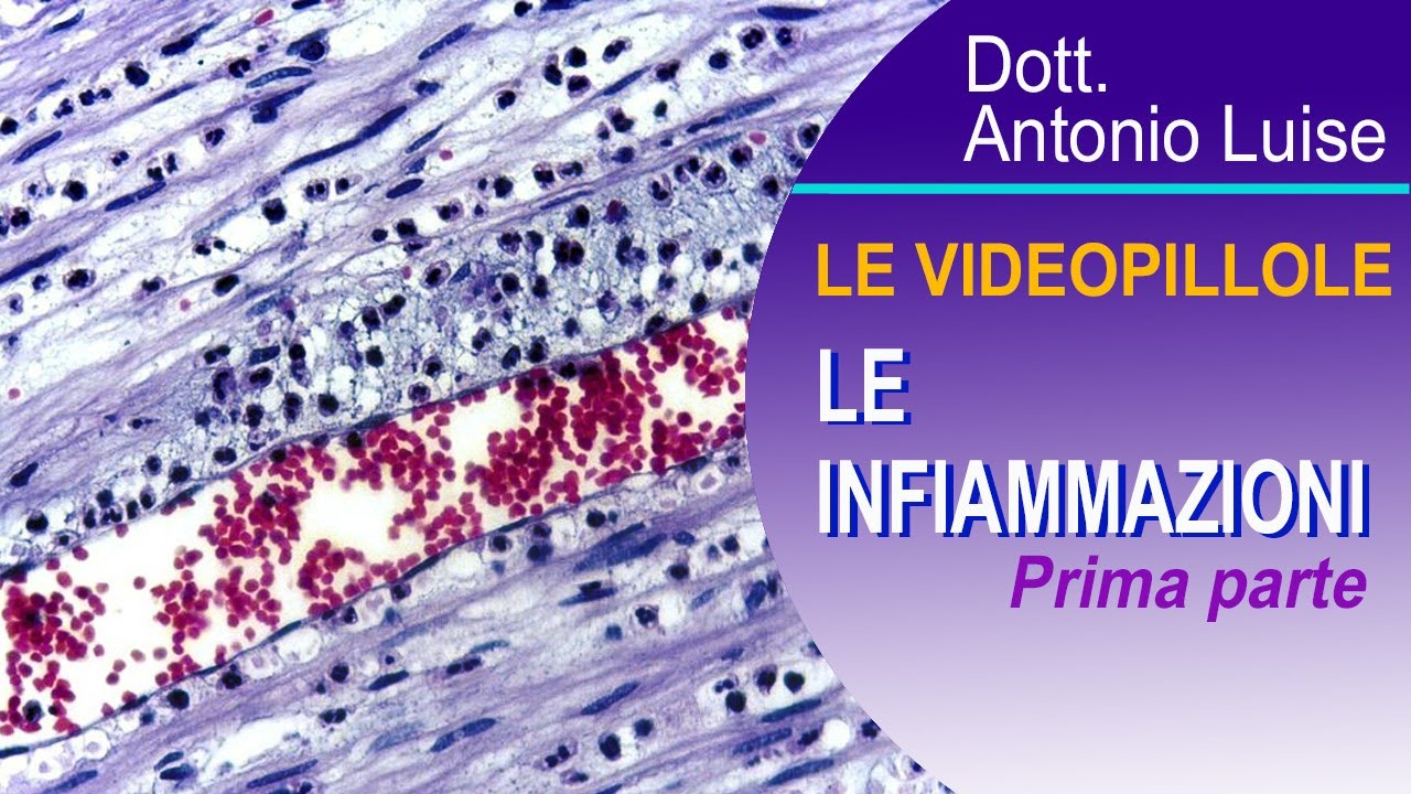 Le Infiammazioni 1