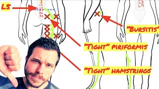 Trigger Point Release for Piriformis Muscle Not Working?