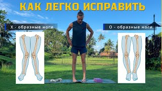 How to effectively correct bow legs at home in 3 minutes. Beautiful legs without surgery.