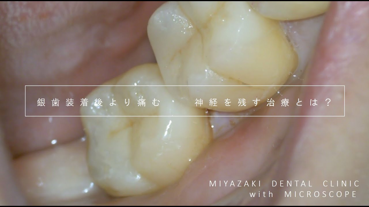 Why do I experience pain, discomfort, and stinging after