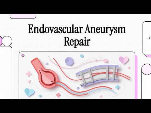075 Endovascular Aneurysm Repair