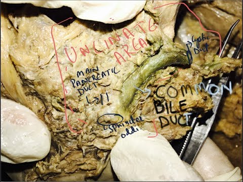 Human Cadaver Dissection - Pancreas Head & Ducts - YouTube