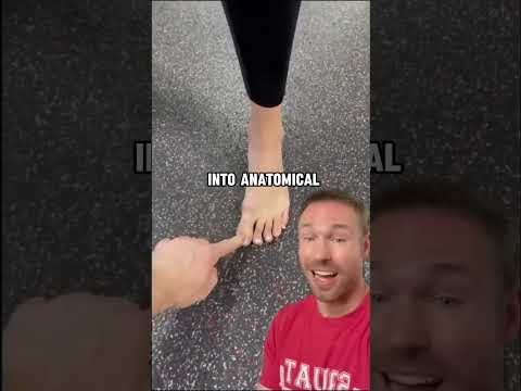 How to build foot arch & fix flat feet without using orthotics #shortsfeed