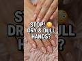 ✨ “Dry Dull Hands?”💖 “Try This!” #shorts#beautytips #handcare #glowup #beauty #shorts