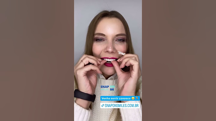 Comprei um snap on smile! Será que deu certo?