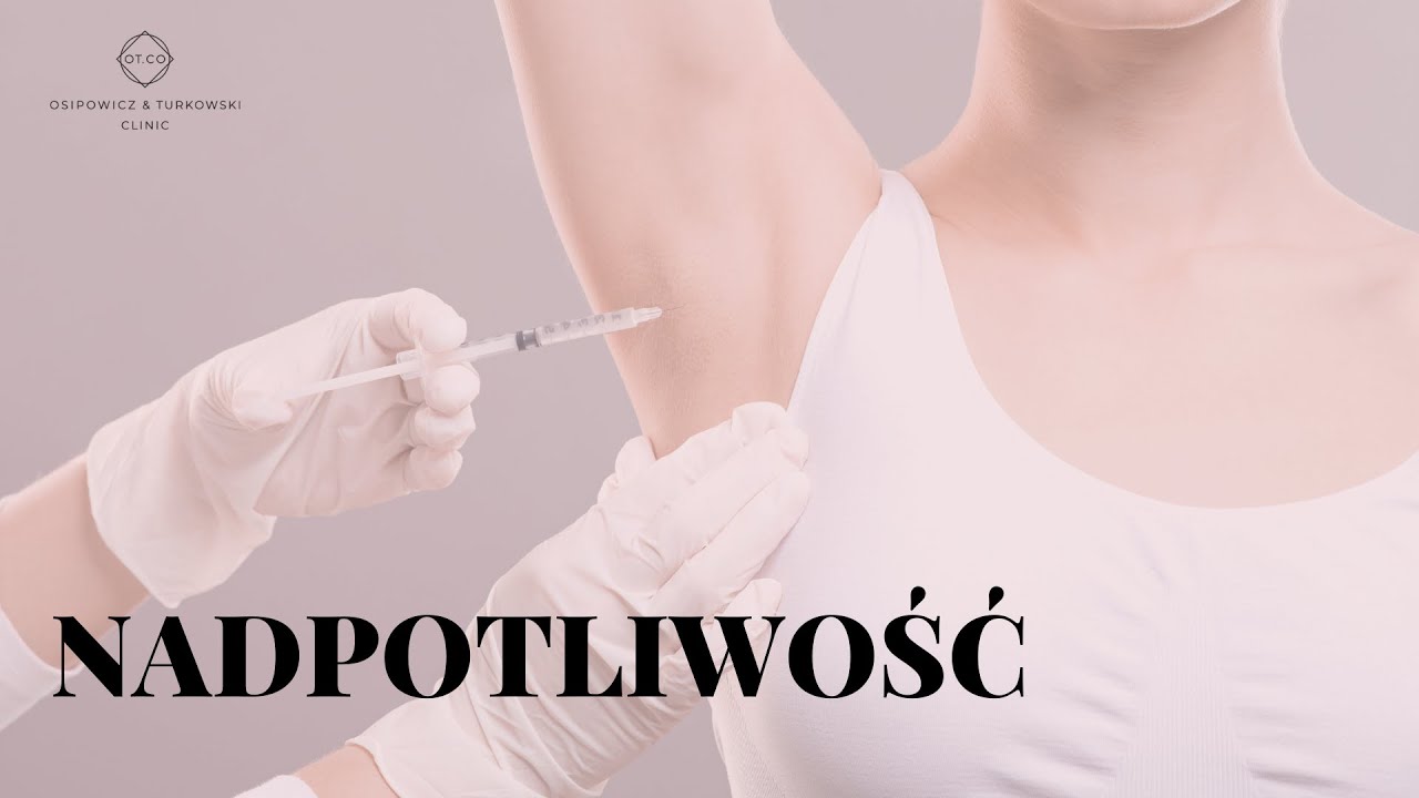 Leczenie nadpotliwości - przebieg zabiegu, pytania i odpowiedzi