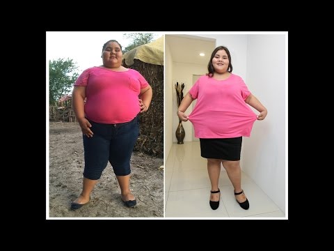 Adolescente mexicana con sobrepeso baja 90 kilos y se prepara para celebrar sus 15 años