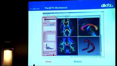 16 - K. Maier-Hein - MITK -- Medical Imaging Toolkit software for DTI processing