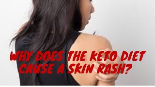 Why does the keto diet cause a skin rash?
