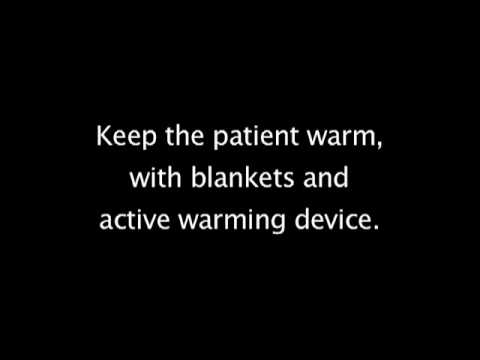 video editing software free Burns 101 Triage