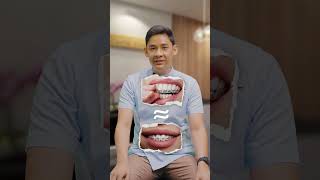 Top 3 myths about Invisalign - busted!