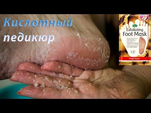 НОСОЧКИ для ПЕДИКЮРА - шокирующий результат!