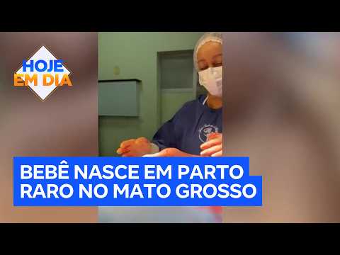 Baby born inside amniotic sac in rare delivery in Mato Grosso