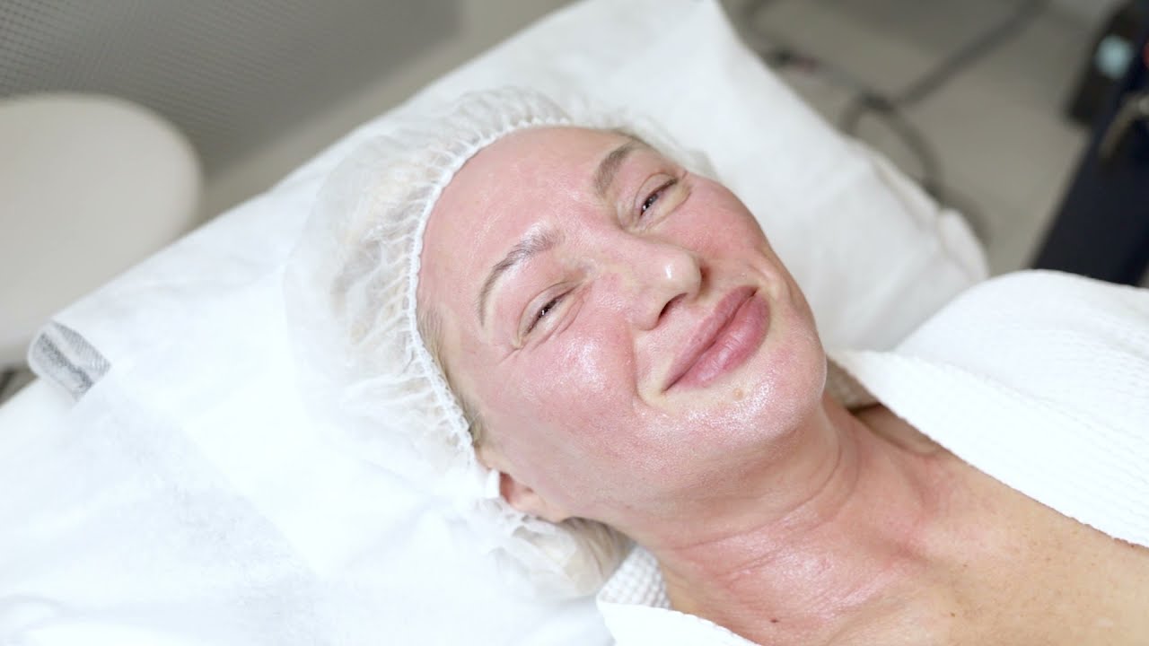 Дневник поколения Ageless - 2 СЕРИЯ | Сеть клиник косметологии GEN87