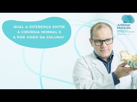 Vídeo: Qual é a diferença entre uma coluna e uma postagem?