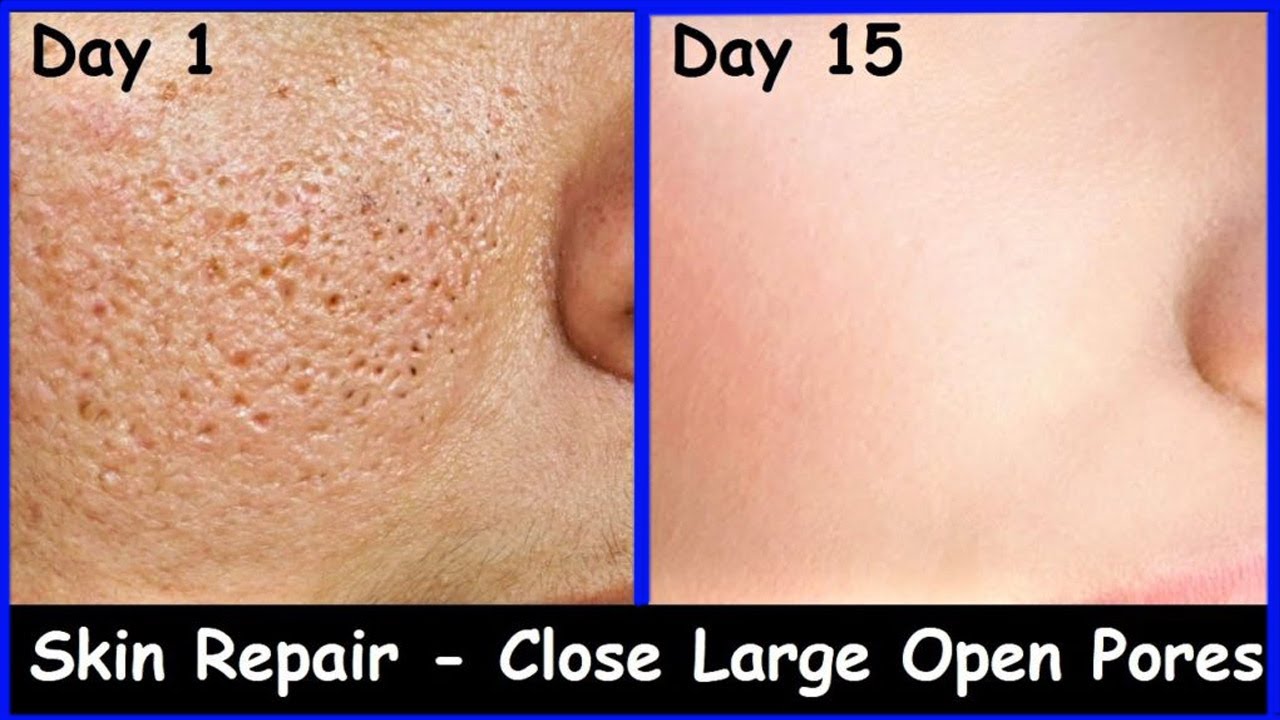 Tighten Open Pores and Remove Dark Spots - Get Milky Glow Skin